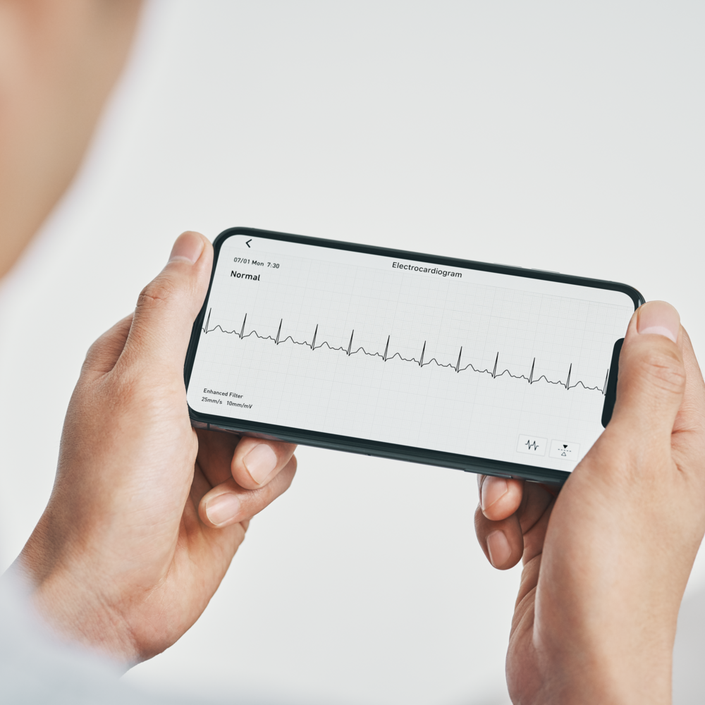 Tuotekuva: Omron Complete EKG- ja verenpainemittari